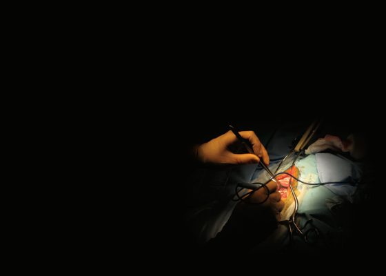 In a dark operating room, two gloved hands are visible performing surgery.