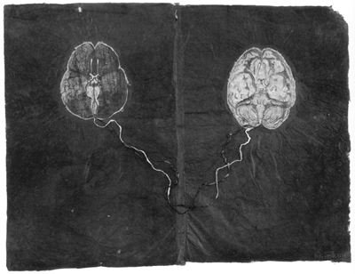 Untitled) Two Brains, Kiki Smith, 1994, lithograph with collaged lithographs on two attached sheets of handmade Japanese paper, 29.5 × 39 inches; © 1994 by Kiki Smith